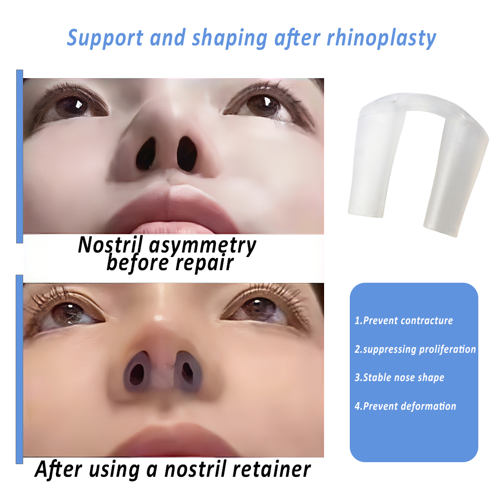 코 성형 수술 후용 콧구멍 지지대, 실리콘 수술 후 콧 - Anti Snore Contour Pillow 리뷰 및 가격