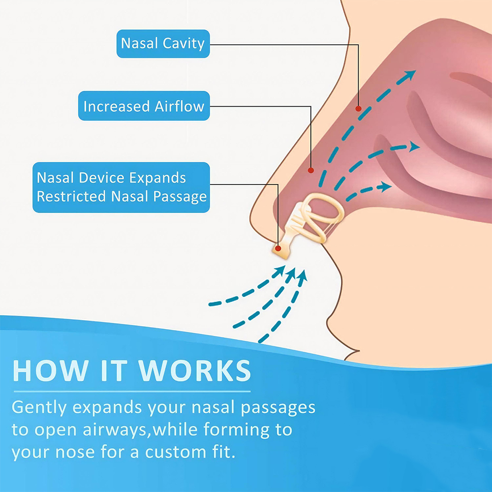 코골이 방지 비강 확장기, 코골이 감소, 공기 흐름 증 - Anti Snore Contour Pillow 리뷰 및 가격